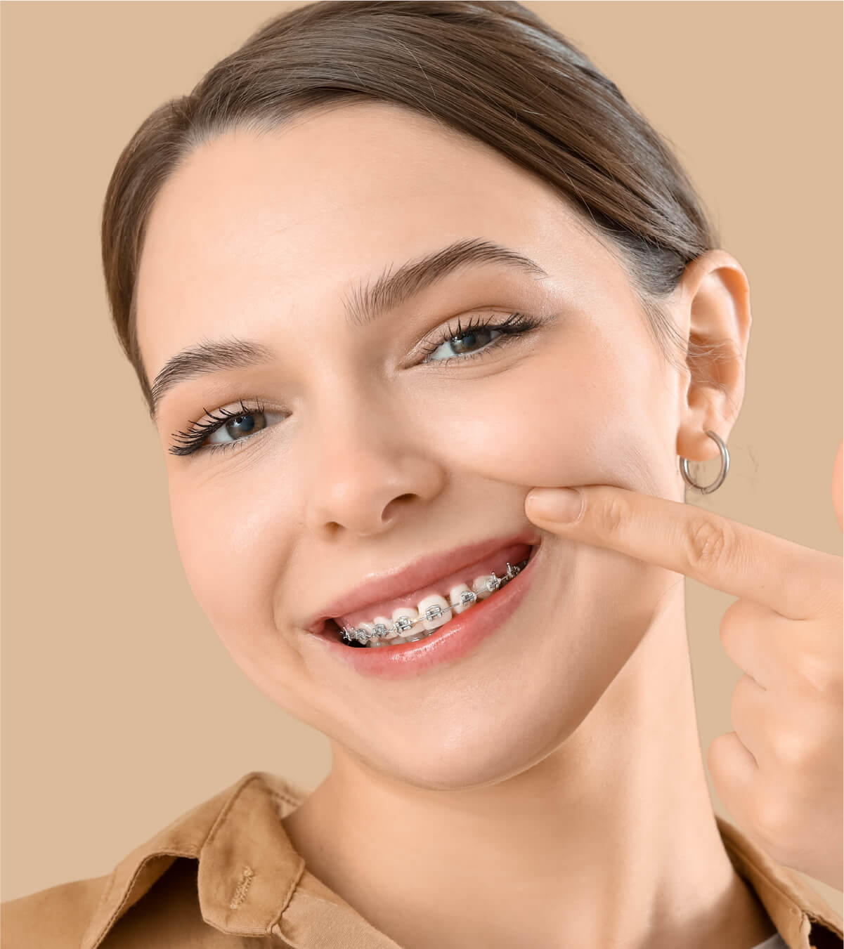 What Are Dental Crowns?